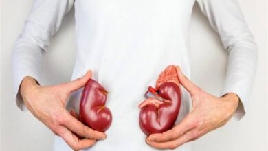 احمي نفسك .. اعرف أسباب الإصابة بسرطان الكلى وأهم علاماته